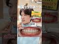 韓国の歯のラミネート技術がすごいと噂を聞いて行ってきた🦷
