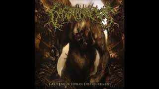 Gastrorrexis - Grotesque Human Disfigurement (Full Album)