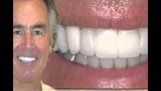 Download lagu Boca Raton Dentist Martin R. Polin, DMD & Carly S. Polin, DMD