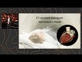 'Hedging against Heart Attacks' - Professor Jason Kovacic at SOHN Hearts & Minds Conference 2022