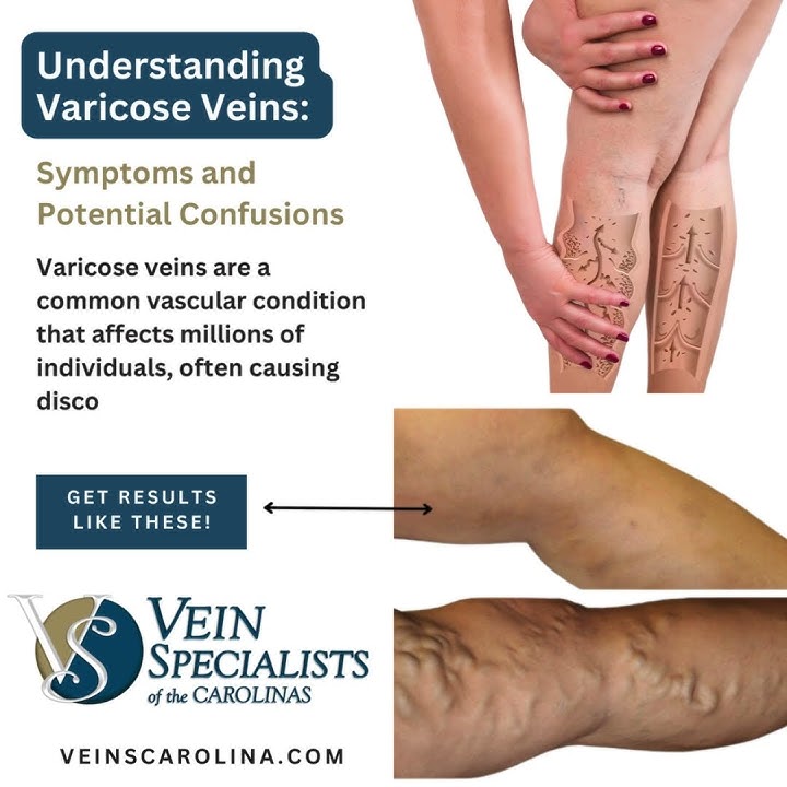 Medical Compression and Deep Vein Thrombosis (DVT) 