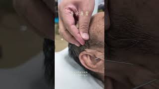 Deafness And Brain Tinnitus In Traditional Chinese Medicine