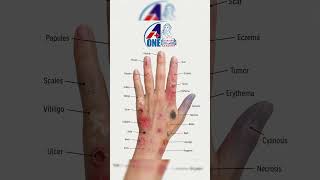 “Common Skin Lesions: Identification and Clinical Overview”#skindisorders #shorts #nursinglife #tips