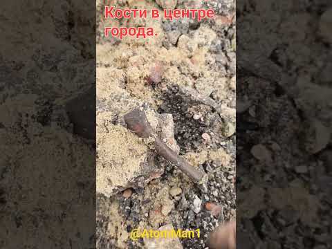 Кости в цетре