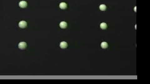 Optokinetic Nystagmus (OPK) in Videonystagmogram (VNG) testing