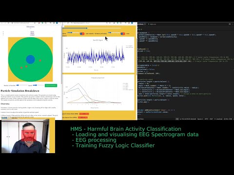 Mastering ECG and