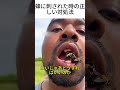 蜂に刺された時の正しい対処法