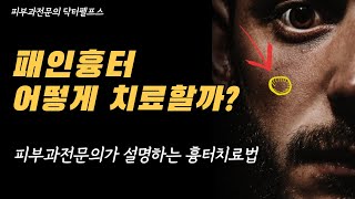 패인 흉터의 치료