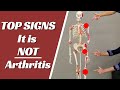 Top 5 Signs Your Shoulder, Hip, or Knee Pain, Is NOT Arthritis
