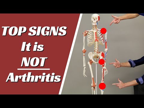 Video: Why Do The Joints Of The Arms, Legs, Fingers, As Well As Knee, Elbow, Shoulder Joints Hurt?