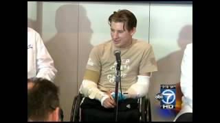 Brendan Morrocco receives double-arm transplant