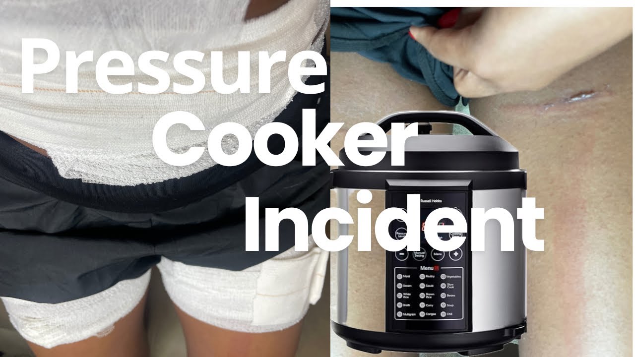 I Almost Died From Pressure Cooker Explosion