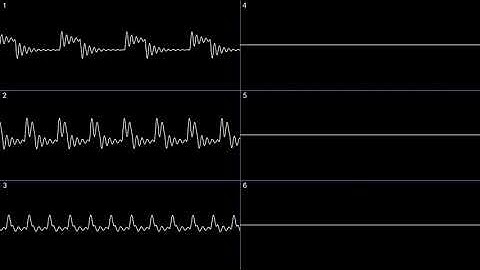 kleeder - basic classic (oscilloscope)