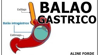 BALAO GASTRICO - PREPARATIVOS ANTES DE COLOCAR 2016 | ALINE FORDE