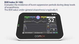 Conox Smart Anesthesia
