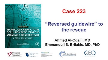 Case 223: Manual of CTO PCI - Reversed guidewire to the rescue
