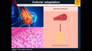 Cellular Pathology - Metaplasia