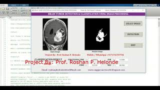 Detection of Brain Tumor Using Matlab Code | Brain Tumor Classification Using Matlab Source Code
