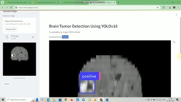 🚀😊 Brain Tumor Object Detection Using YOLOv10 | Python |  😊🚀