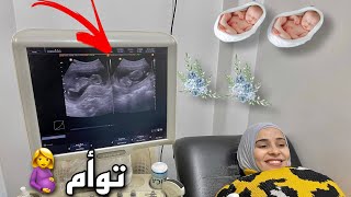 مراتي حامل في توأم 👶👶 اجمل هدية ربنا بعتهلنا في رمضان 😭
