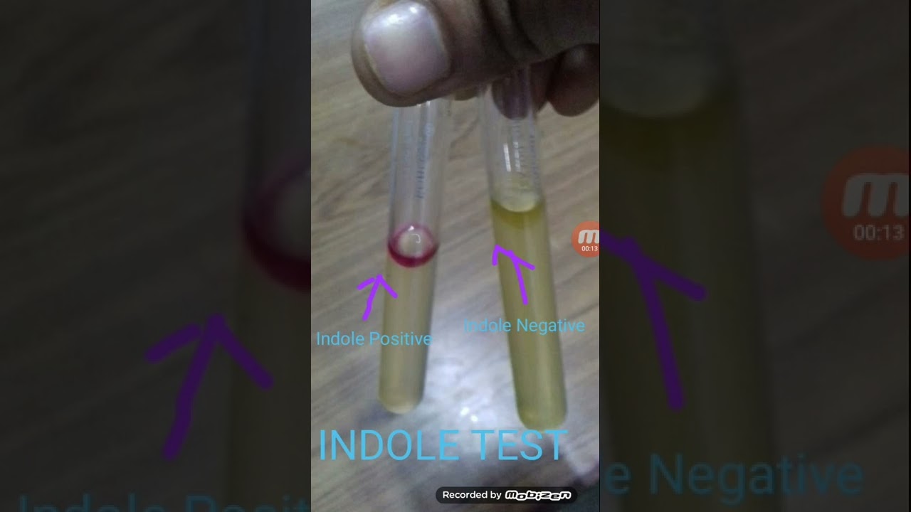 Indole Test Positive and Negative