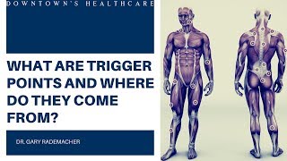 WHAT ARE TRIGGER POINTS AND WHERE DO THEY COME FROM - Downtown s Healthcare of Denver