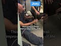 Joey’s journey to get prosthetic legs