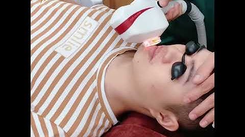 TRIỆT RÂU CHO NAM - SẠCH VĨNH VIỄN - BẢO HÀNH TRỌN ĐỜI