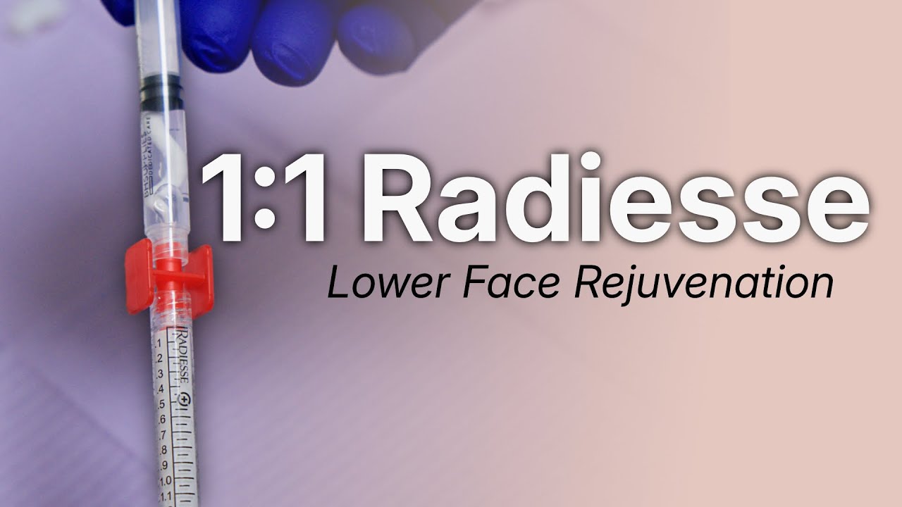 Step-by-Step Guide: Mixing Hyperdilute Radiesse | Part One
