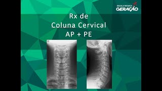 Cervical Spine Radiography - AP   PE