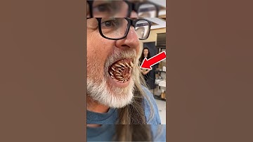 This Guy has Alien Teeth 😳