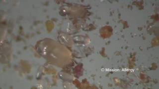 Dust Mites under the Microscope, in Hi-Def.mov