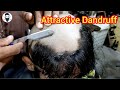 Head Shave 👌Tutorial Attractive Dandruff Shave head for Men 2023