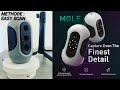 Scanner 3d mole mthode easy scan et jmstudio