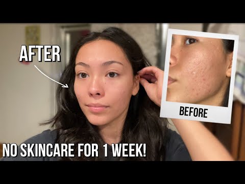 1 Week Without Skincare Products | Results Before x After