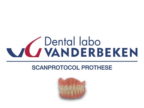 IOS Scanworkflow prothese