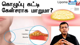கழபப கடட Cancer கடடய மறம Kolupu Katti Lipoma Dr.arun Kumar Explains
