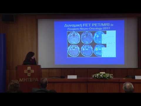 PET/CT και όγκοι