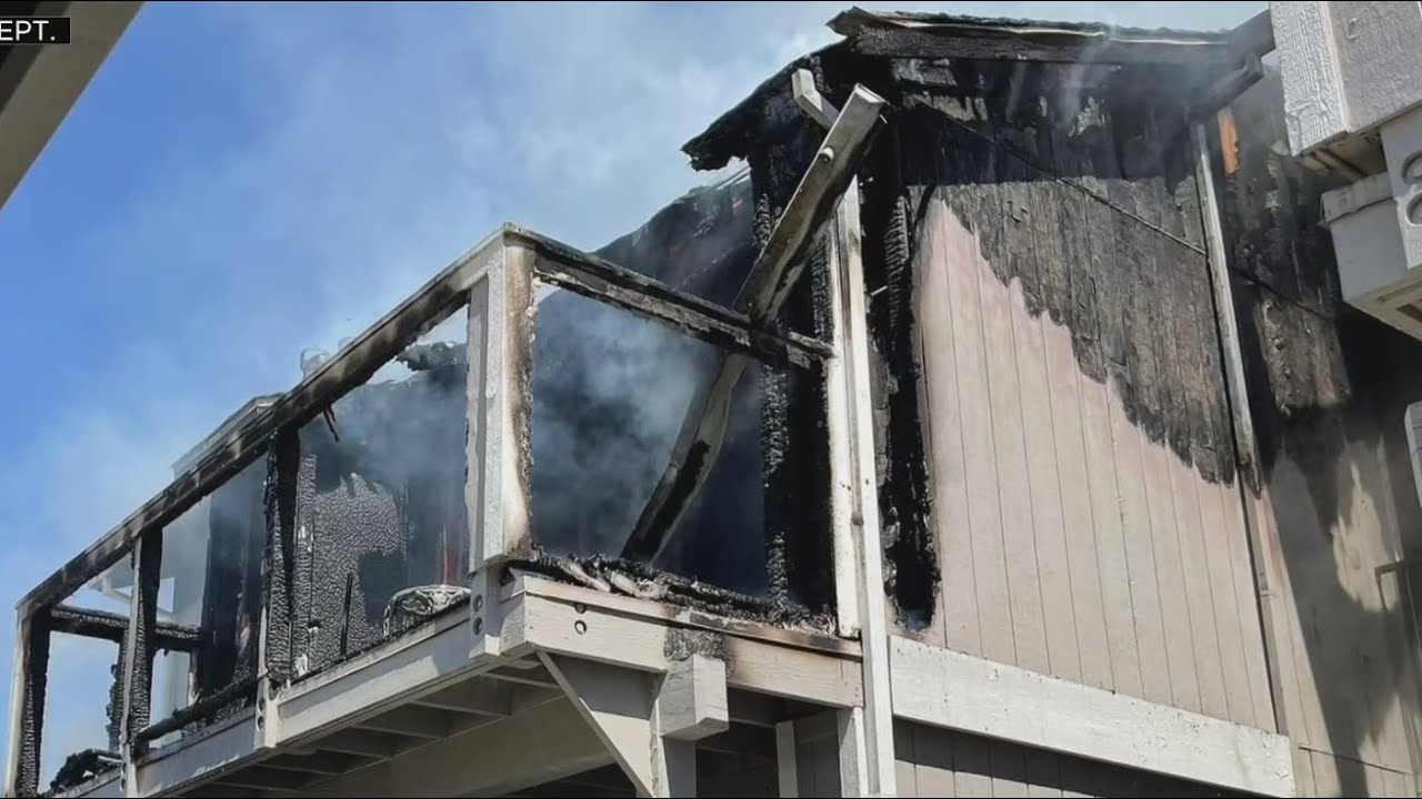 Firefighter recovering from injuries received while fighting a Vacaville fire