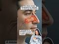 Ты уже не первый год живёшь с ощущением «заложенного носа»..