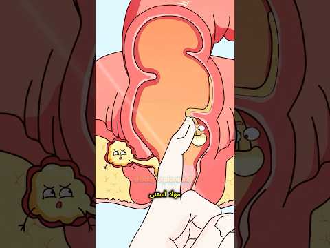 عالق في مأزق من البراز إلى الخراج 