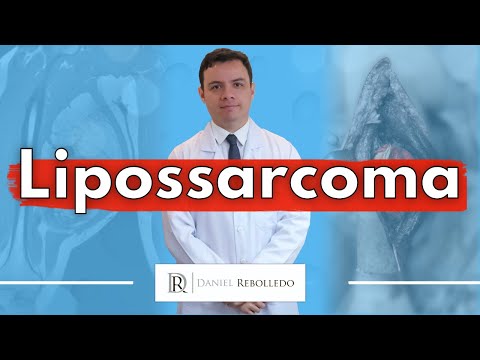 Vídeo: Lipossarcoma: Sintomas, Tipos, Tratamento, Prognóstico