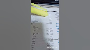 How to find the CPT code for: bilateral wedge resection of the ovaries