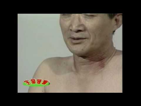 经络刮痧 6 ：高血压 吕教授