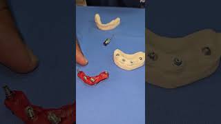Digital Impression and Verification Jig