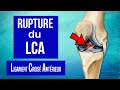 Rupture du ligament crois antrieur du genou lca  les traitements