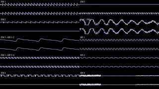 Castlevania Harmony of Dissonance - VK2K2 (YM2612 + SN76489) (100 Sub Special)