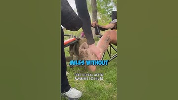 Feet After a 100 Mile Marathon (‪@BrockCovington‬)