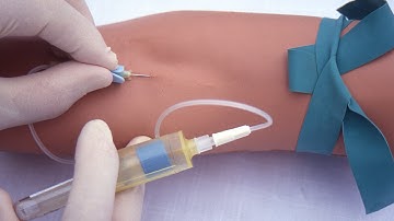 Performing a venipuncture using a butterfly needle