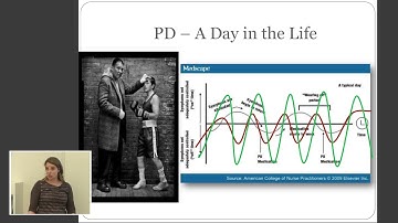 When is the right time to consider DBS?